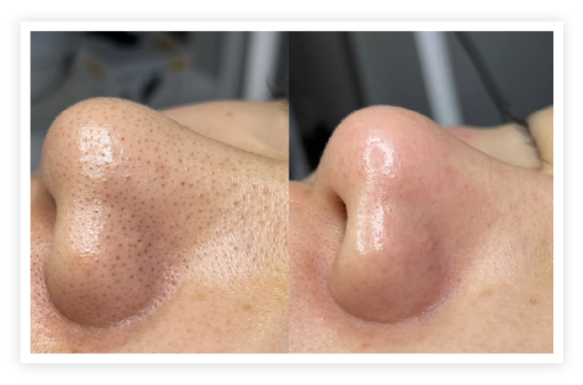 施術の流れのイメージ