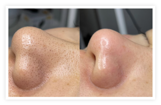 透明感あるツヤ肌体験の画像